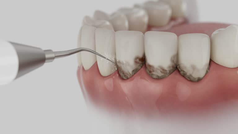 Reliable Dental contractor in Bartonsville, MD by Dentist Open Now